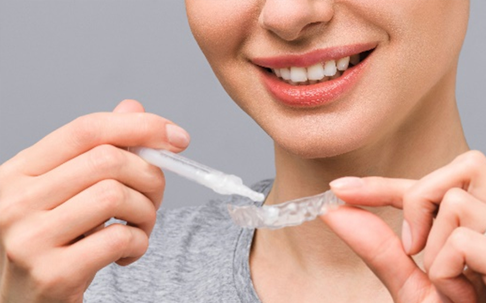 ホームホワイトニング